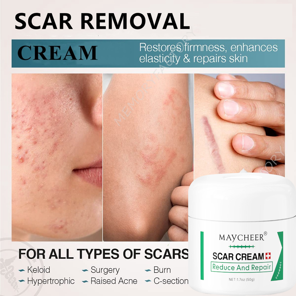Scar Repair Cream Remove Acne Scar Stretch Mark Scald Scar Removal ... - Acne Removal Cream For Legs