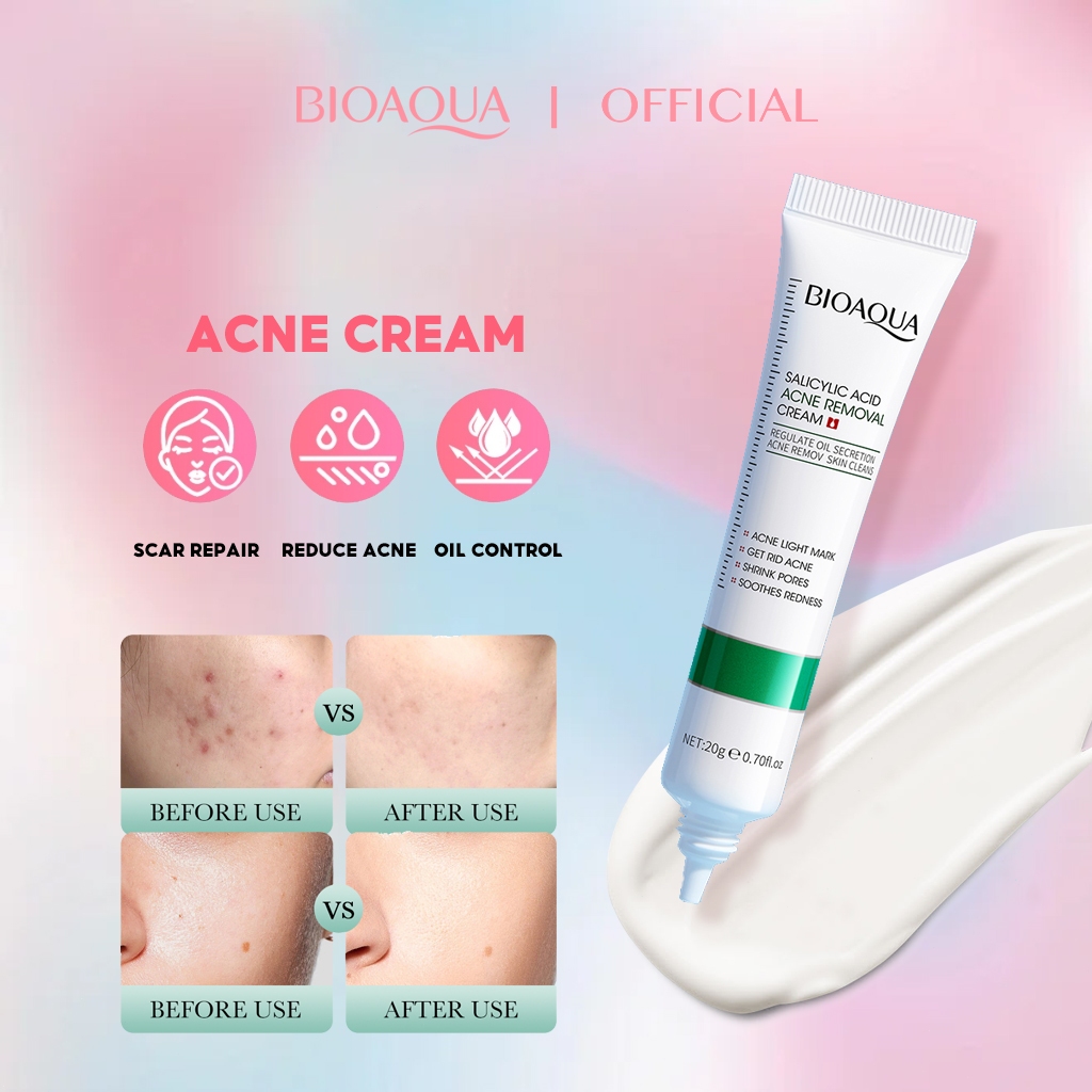 BIOAOUA Salicylic Acid Acne Removal Cream | Shopee Philippines