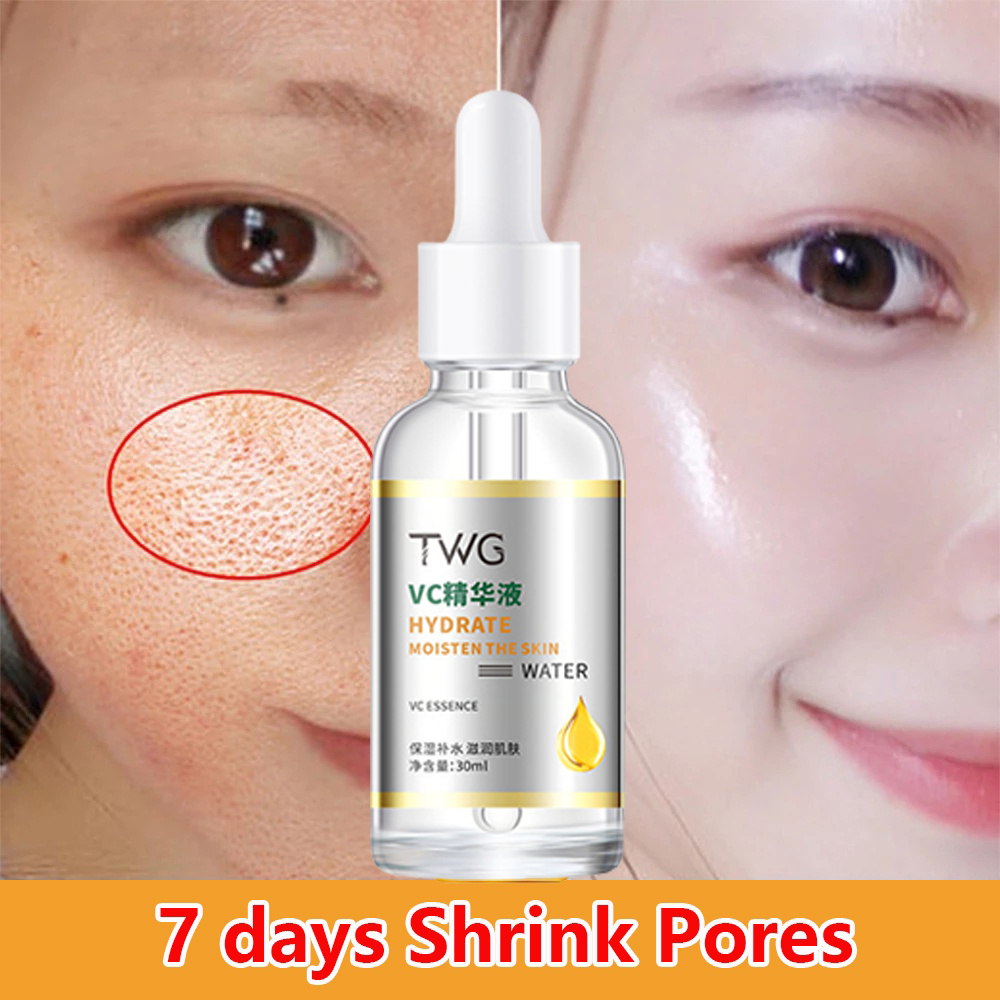 Vitamin C Serum White Melasma Dark Spot Remover For Face Melasma