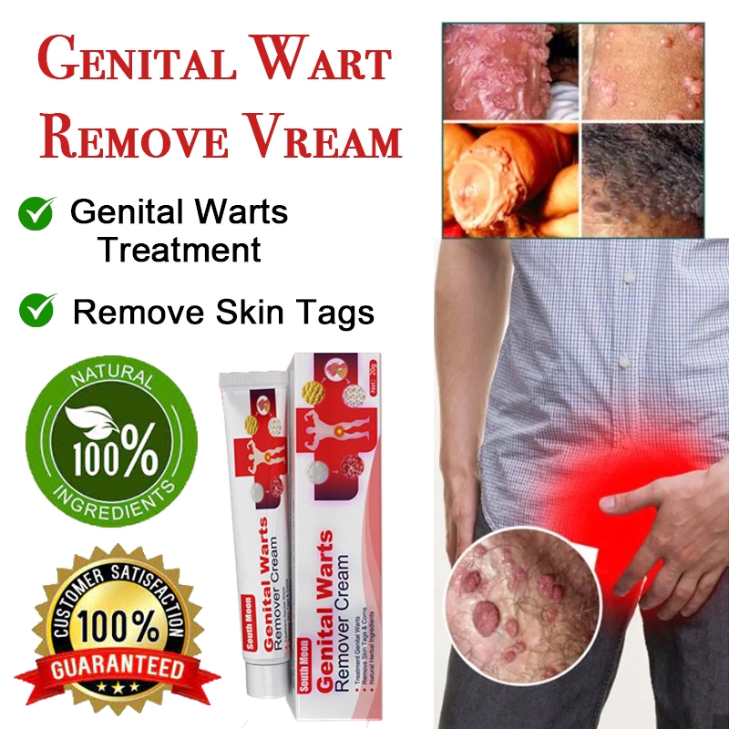 Genital Wart Remove Cream Mole Skin Tag Wart Removal Ointment