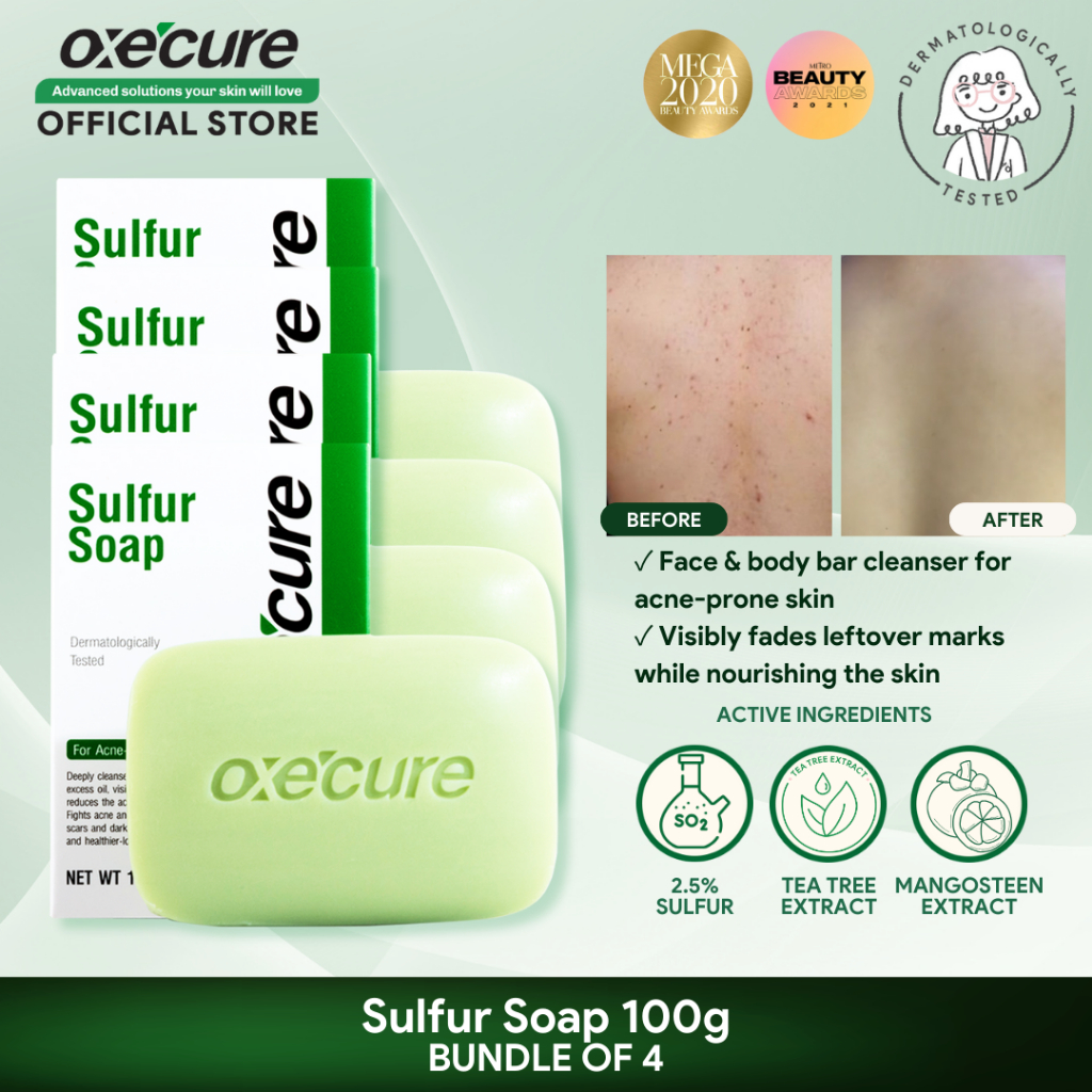OXECURE Sulfur Soap 100g Bundle of 4 Shopee Philippines