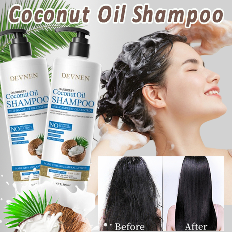 DEVNEN Coconut Oil Shampoo Anti-Dandruff Refreshing Control Oil Shampoo ...