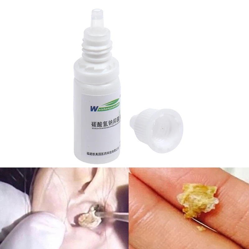 Ear Wax Remover Ear Drops for Earwax Sodium Bicarbonate Earwax Cleaner ...