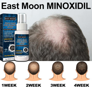 Minoxidil Hair Grower Original Hair Grower For Man And Woman Hair 