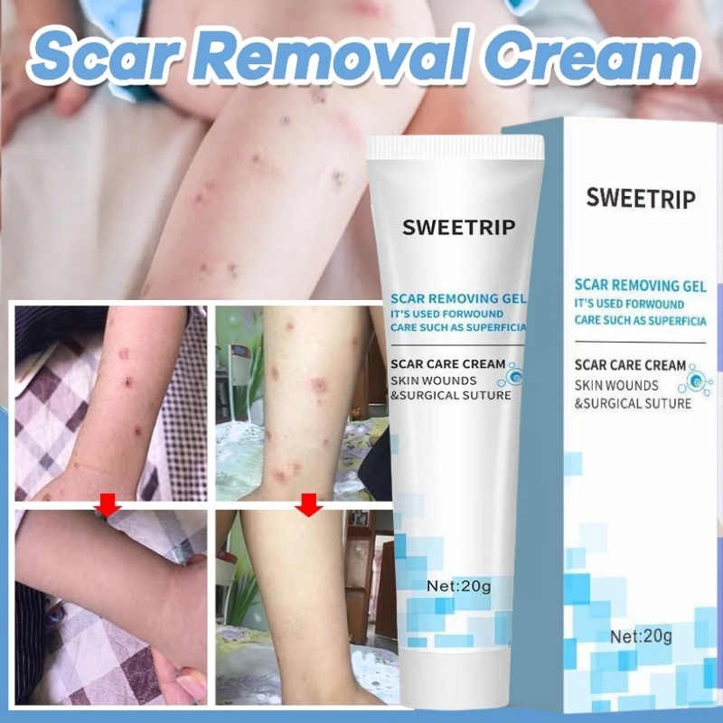 Scar Removal Cream Peklat Stretch Mark Cream Acne Treatment Remover