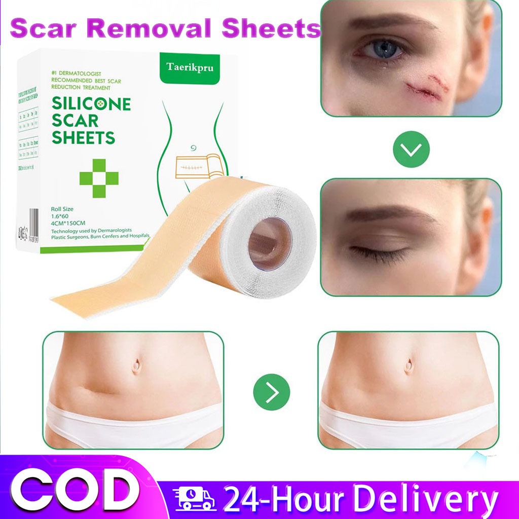 Silicone Scar Patch Remove Trauma Burn Scar Removal Silicone Sheet ...