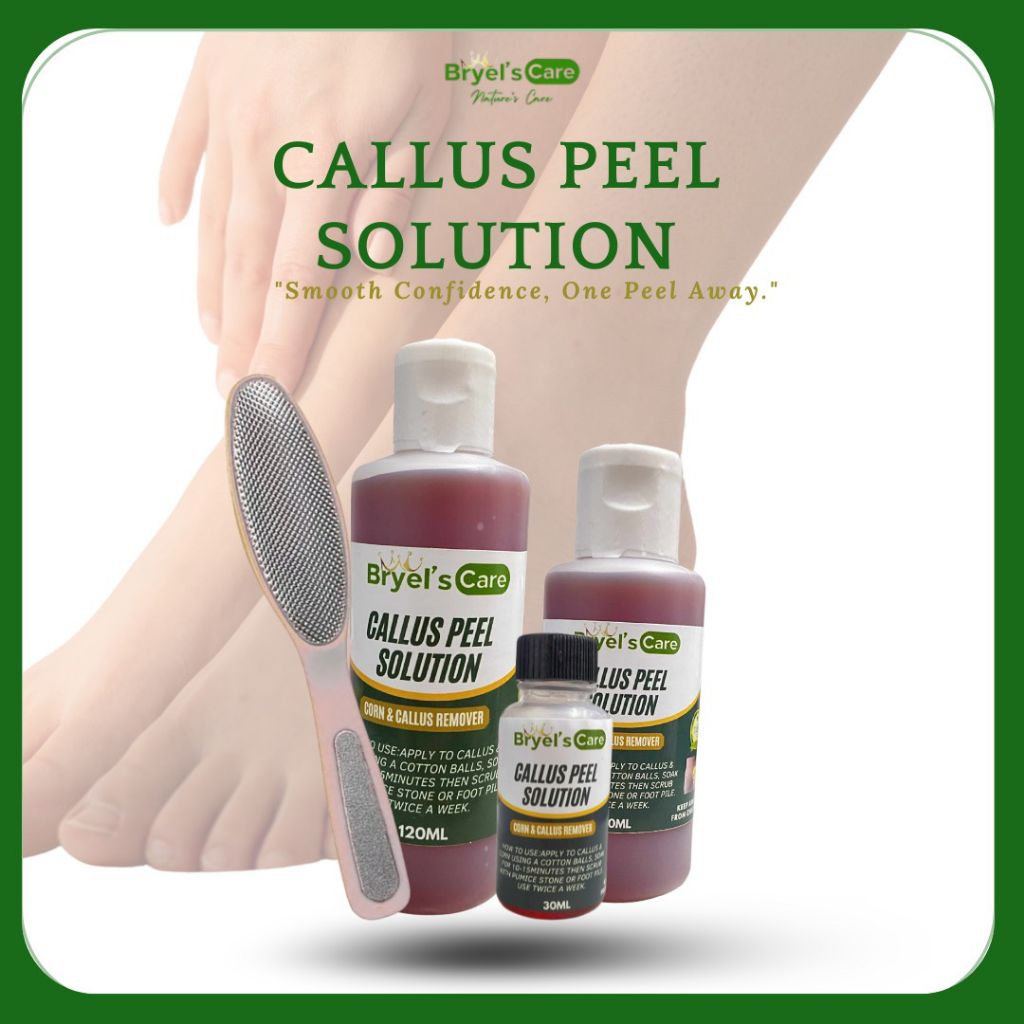 BRYELS CALLUS PEEL ROMOVER SET CALLUS SOLUTION PANTANGGAL KALYO WITH ...