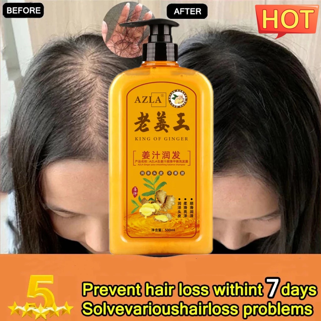 AZLA 500ml Ginger Shampoo - Tulong sa Masiglang Buhok! | Shopee Philippines
