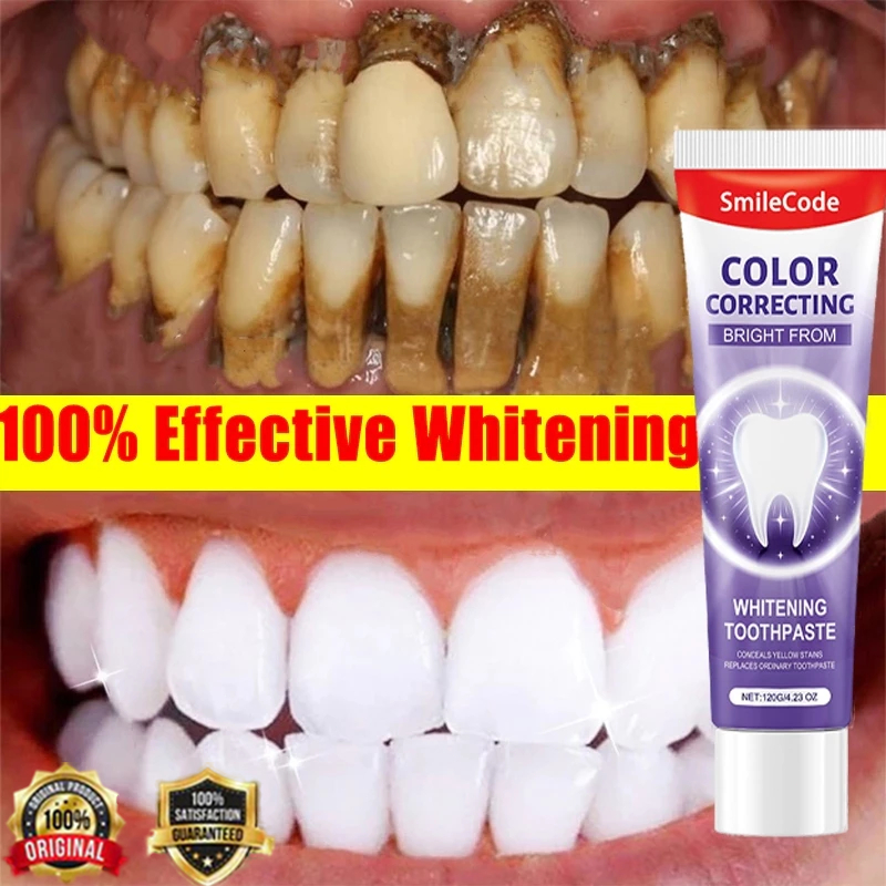 Probiotic Caries Toothpaste Whitening Tooth Decay Repair Paste Teeth ...