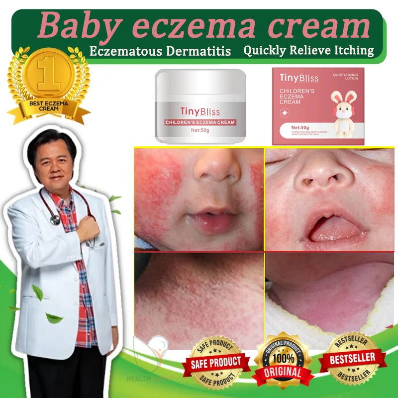 Natural Eczema Cream For Baby Quick Relief For Itchy Skin Mild Not ...