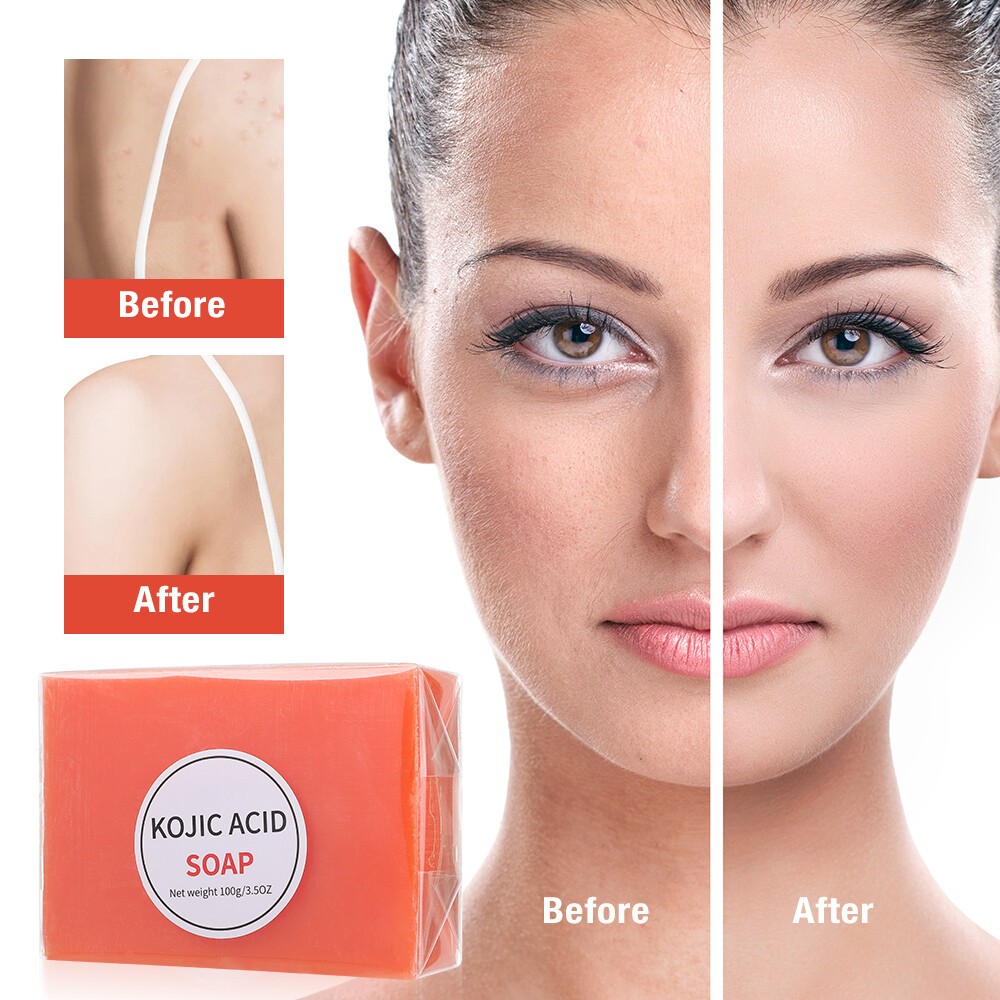 FDA APPROVED Kojic Acid & Glutathione 2-in-1 Lightening Soap 1pack 5pcs |  Shopee Philippines