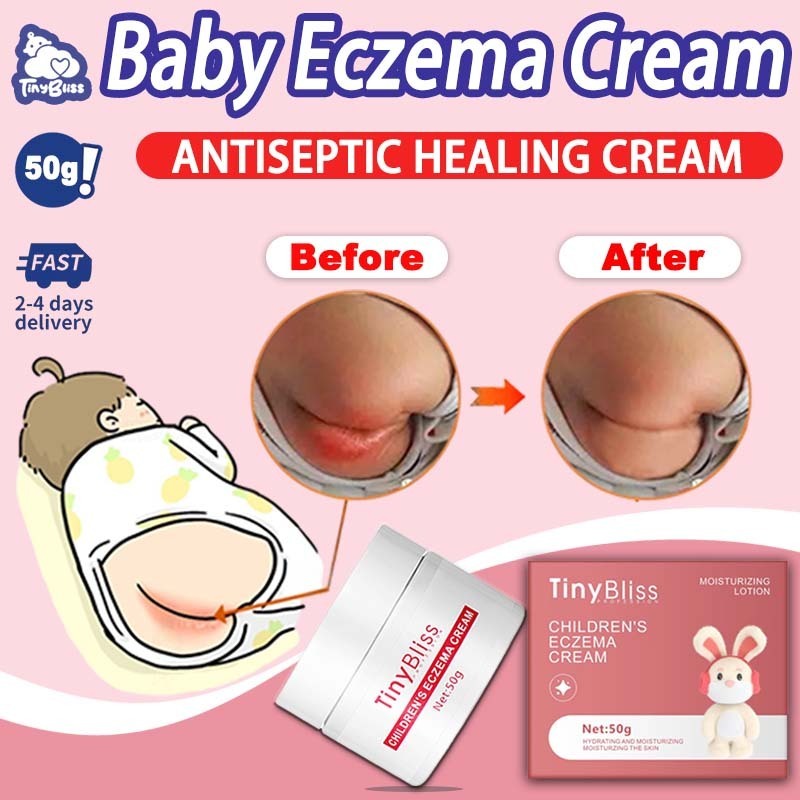 TinyBliss Nappy Rash Soothing Relief Cream(50g) Baby Eczema Relief ...