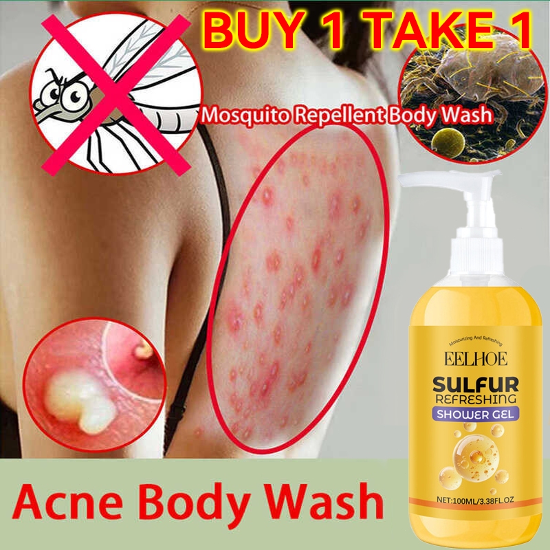 Sulphur Mite Removal Shower Gel Antibacterial Body Wash for Anti acne ...
