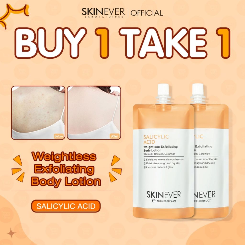 SKINEVER Official Store PH, Online Shop | Shopee Philippines