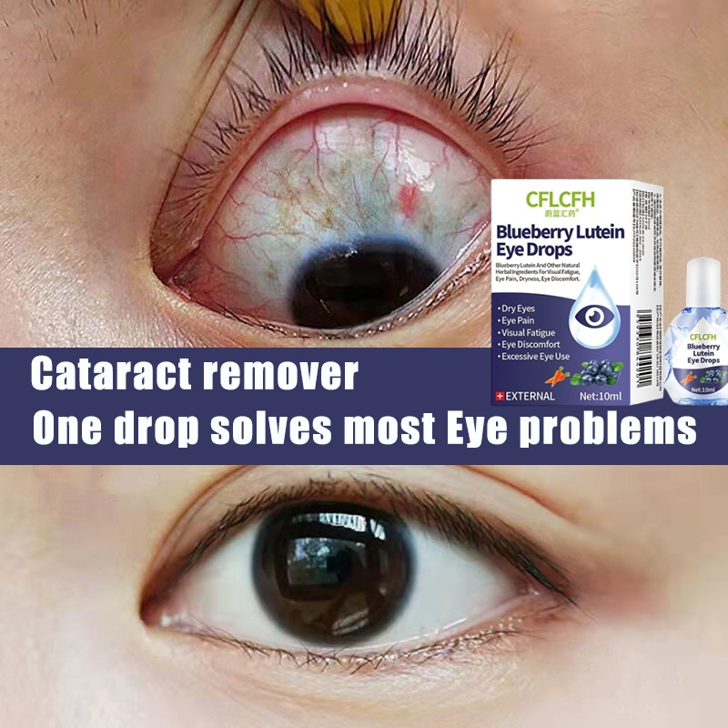 Eye drops for dry eyes eye drops for blurred vision eye drops for