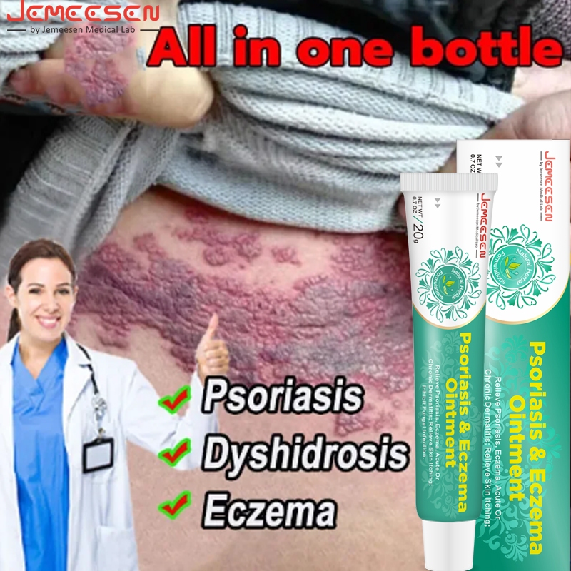 Jemeesen Eczema Treatment cream Dermatitis Psoriasis Pruritus Cream ...