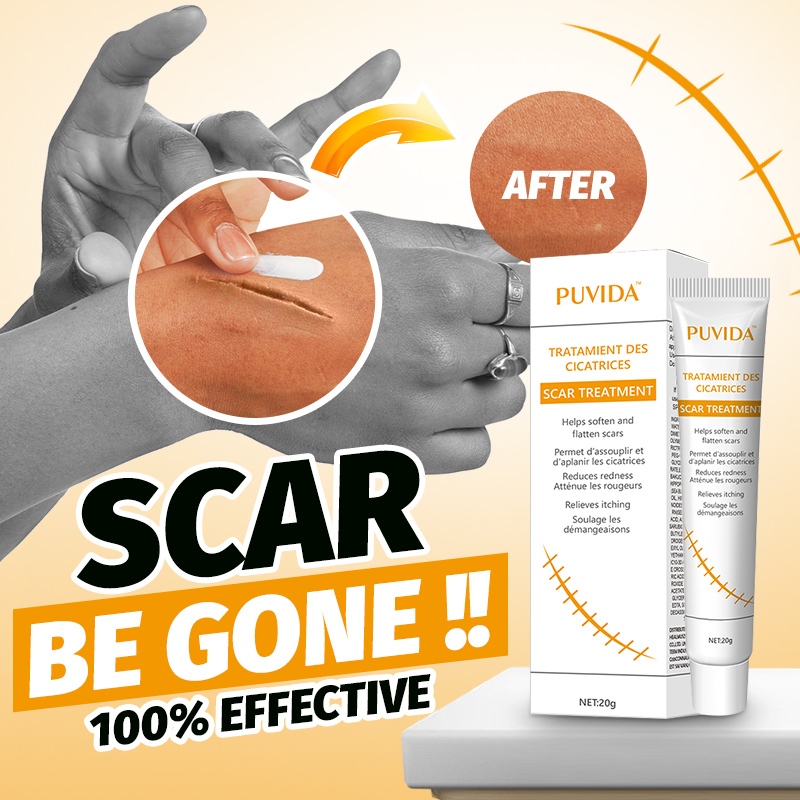 How to Get Rid of Acne on Your Legs? - Necole Bitchie