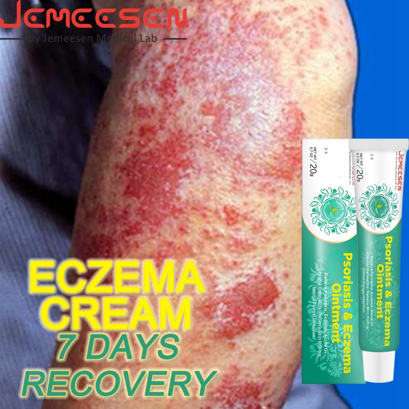 Jemeesen psoriasis cream original ointment for skin allergy eczema ...