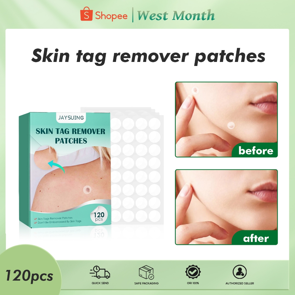 Jaysuing Skin Tag Remover Patches 120pcs Warts Remover Patch Safe ...