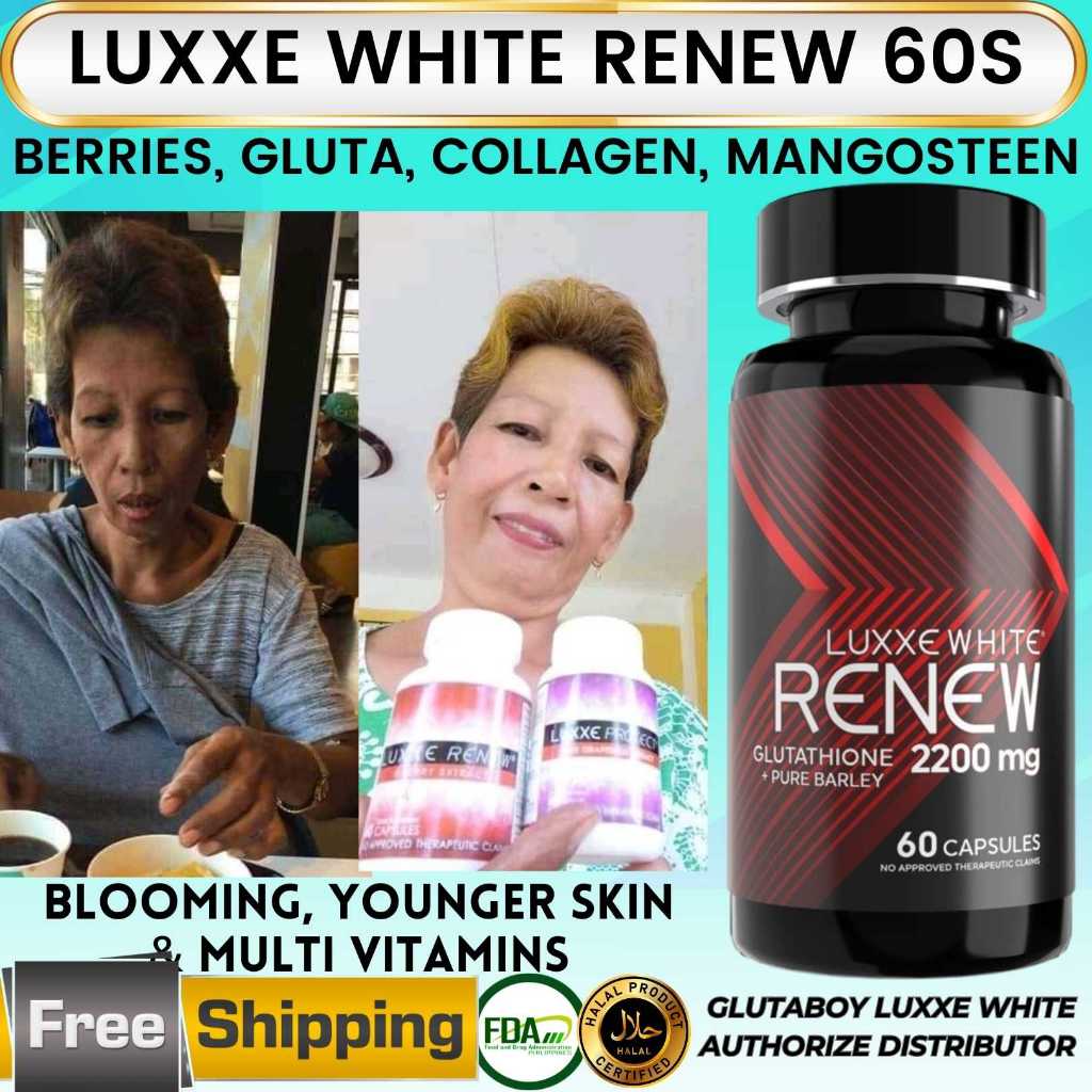 luxxe white glutathione side effects LUXXE WHITE PROTECT ❤️ 😍 Benefits? •Can cure goiter. •madaling mawala yung  varicose • pwede sya sa sugat/peklat (Sobrang bilis ang healing process)  •The best inumin every before mag sleep kahit 3-4hrs