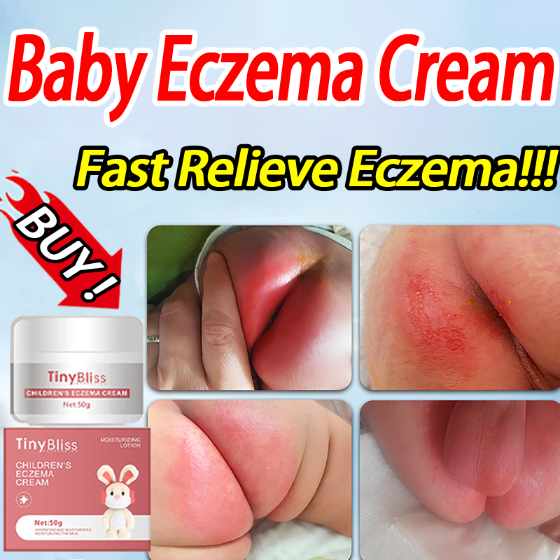 TinyBliss Antiseptic Baby Eczema Cream Relief baby acne Nappy Rash ...