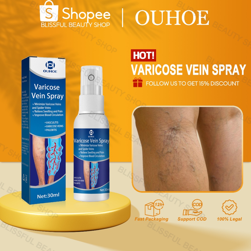 OUHOE Varicose Vein Spray 30ml Varecose Vein Ointment Varicouse ...