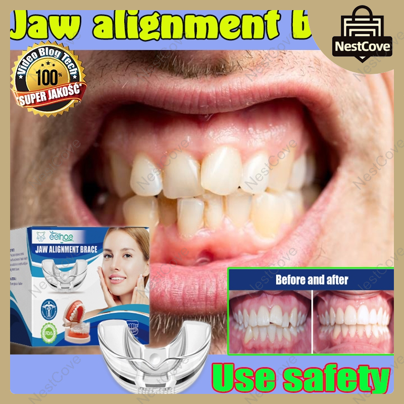 NestCove Dental Orthodontic Appliance Teeth Alignment Teeth Aligner ...