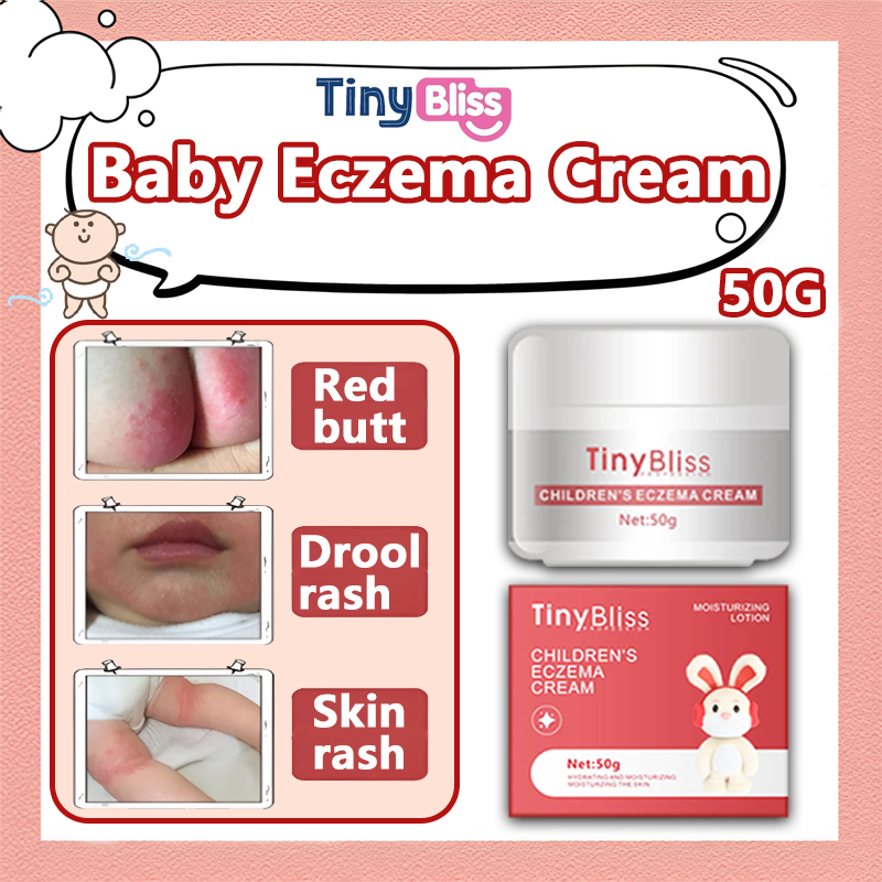 TinyBliss 50G Natural Nappy Cream Baby Eczema Cream Relieves Rashes And ...