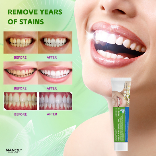 Whitening Toothpaste Bad Breath Removing Toothpaste Toothpaste for ...
