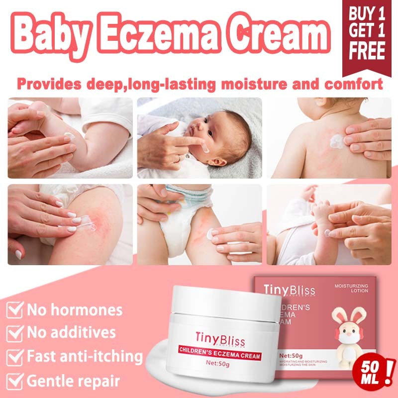 TinyBliss Antiseptic Baby Eczema Cream 50g- Relief baby acne Nappy Rash ...