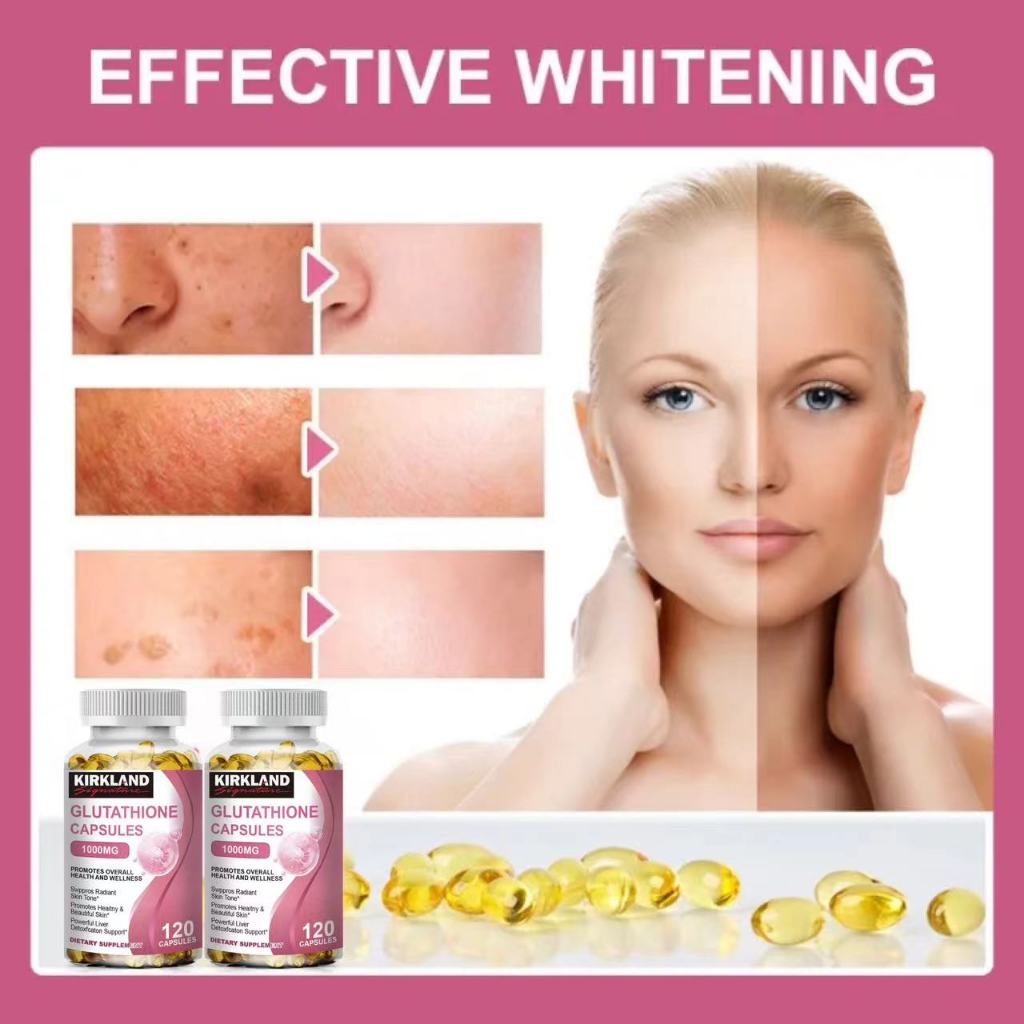 KIRKLAND Glutathione Capsules 1000mg Powerful Whitening Reduce Dull Skin  Supplement Antioxidant | Shopee Philippines