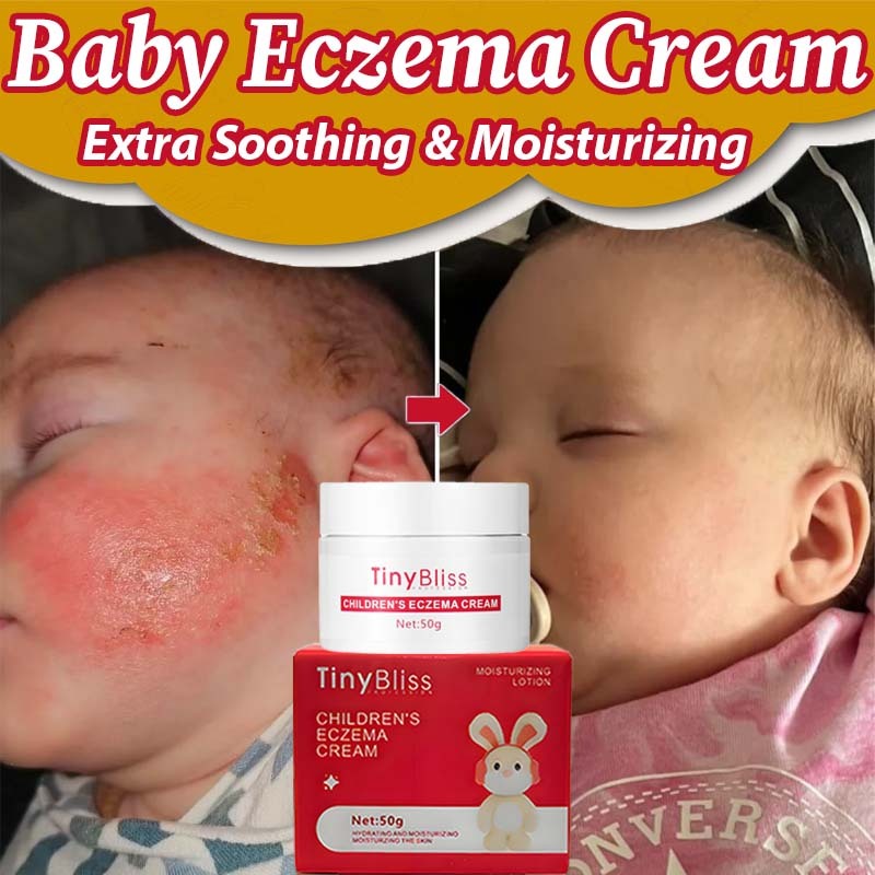 TinyBliss Baby rashes cream Rash Cream Diaper rash cream ointment for ...