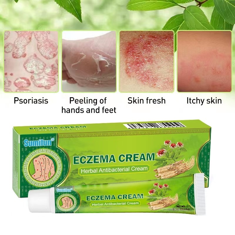 Eczema Cream Dermatitis gamot sa kati sa balat Ointment for Itchy Skin ...