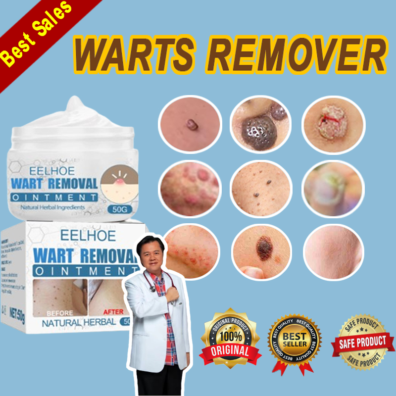 Warts Remover Original Cream Effectively Kulugo Skin Tags Mole Remover ...