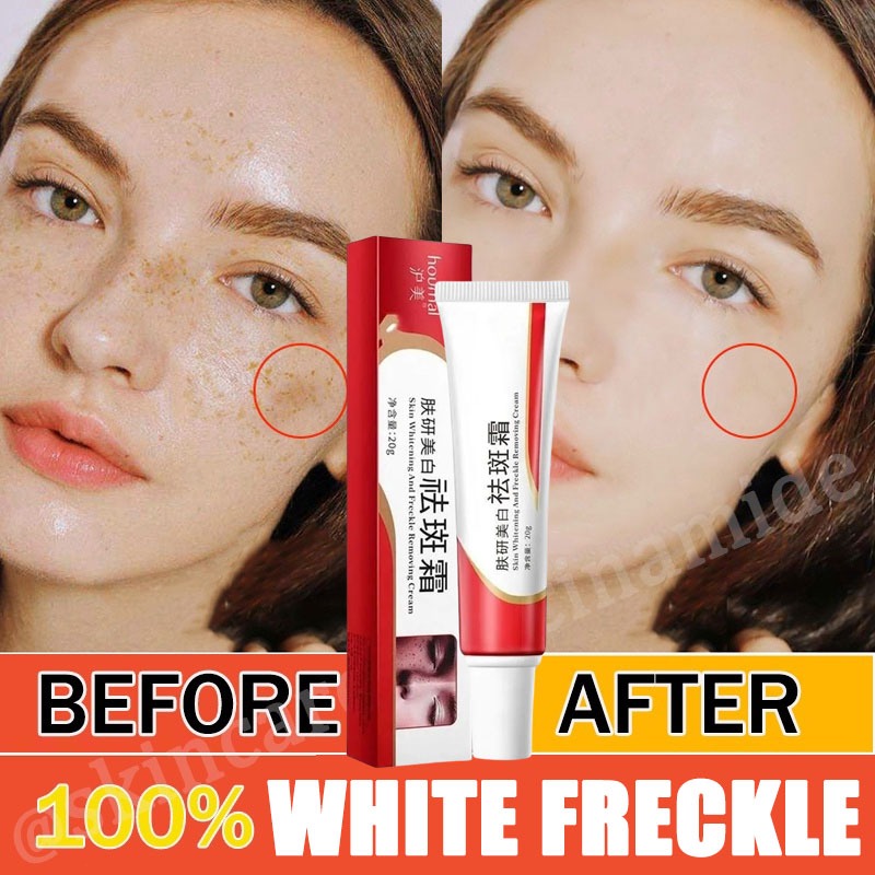 Melasma Cream Collagen Japan Original Pekas Remover Cream Original ...