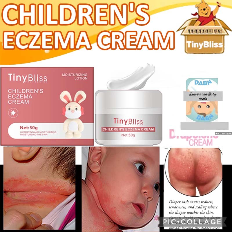 TinyBliss Baby ezcema cream Diaper rash creams Antiseptic Healing Cream ...