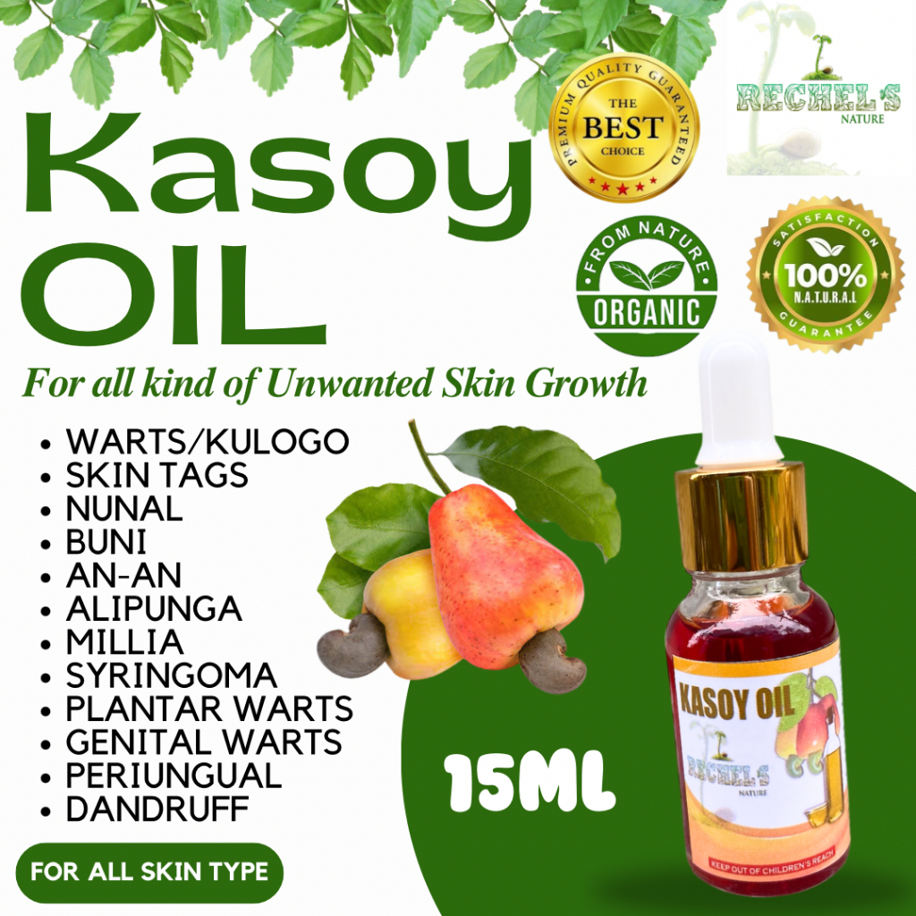 15ml Kasoy Oil( Extract )Solution for Warts, Mole, Skin tags Remover ...