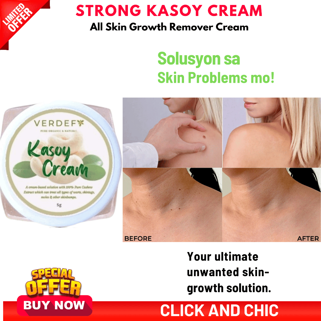 Original Strong Kasoy Cream warts remover original mole remover kasoy ...