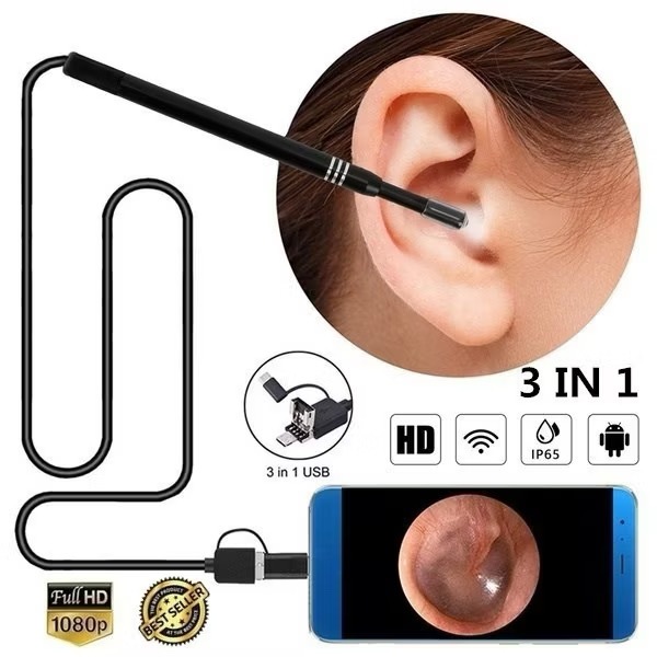 New 3In1 Usb Earpick Mini Camera Endoscope Ear Cleaning Tool Hd Visual ...