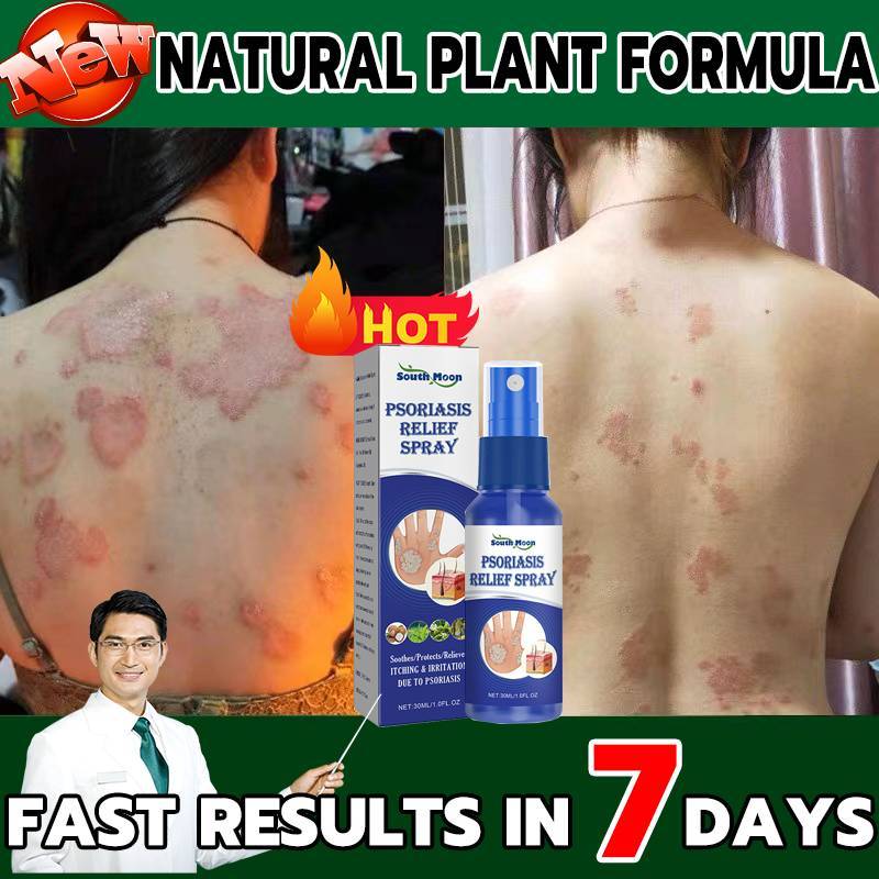 Psoriasis & Eczema Cream Antibacterial Relieve Itching Soothe ...