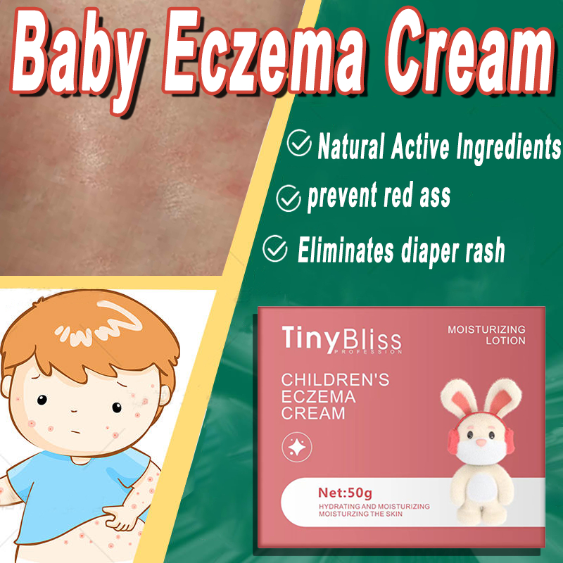 TinyBliss Baby Eczema Cream Nappy Rash Cream Surface Wounds Skin Care ...