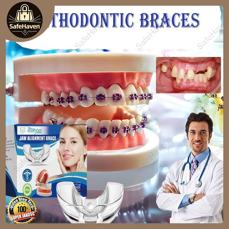 SafeHavens Dental Tooth Orthodontic Appliance Teeth Alignment Teeth ...