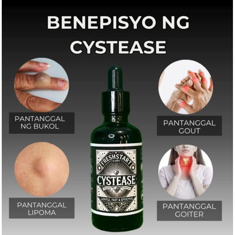 COMPLETE SUPPORT FOR YOUR HEALTHY NEEDS CYSTEASE | Shopee Philippines