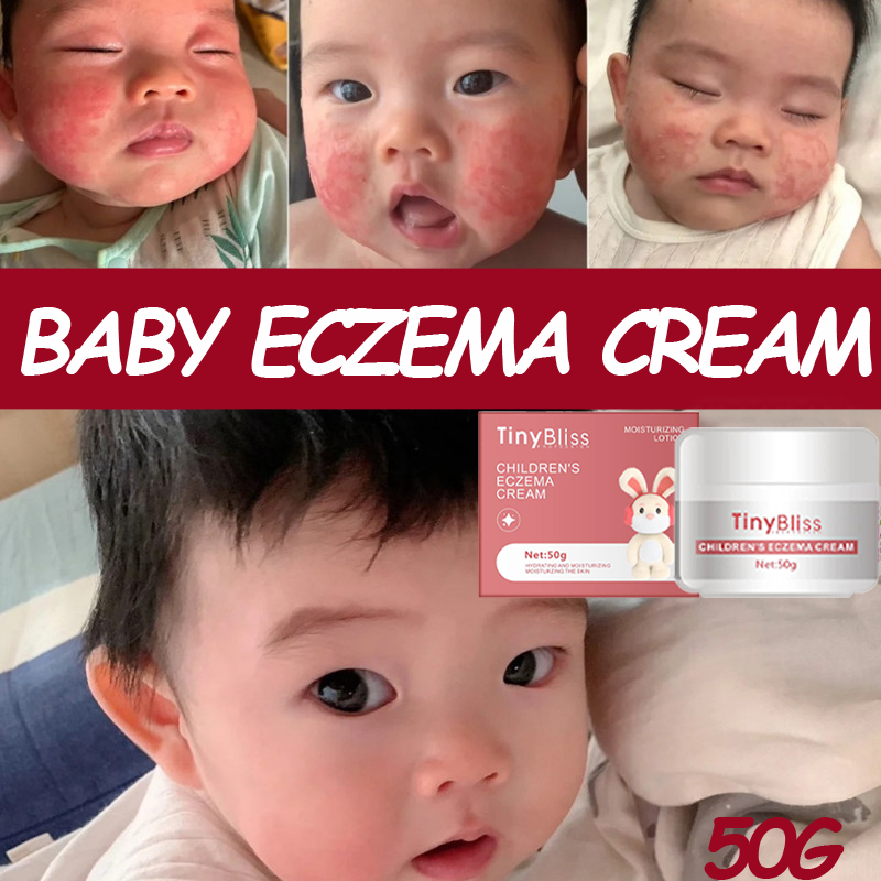 tiny bliss eczema cream skin rashes cream Nappy Rash Relief Antiseptic ...