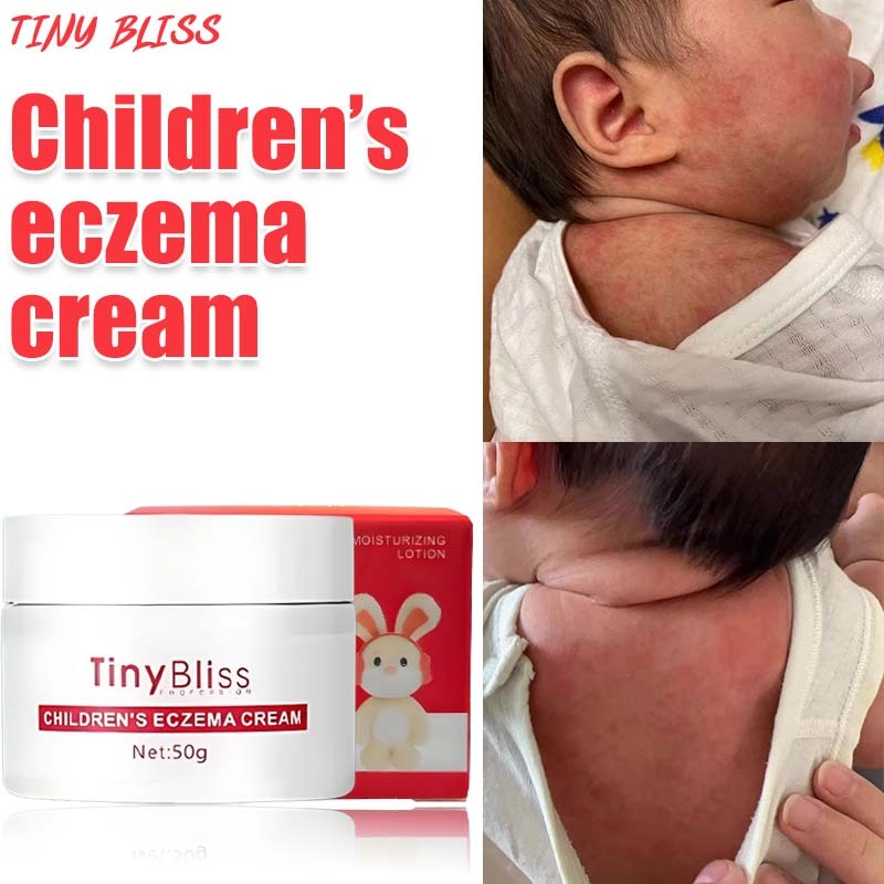 Tinybliss baby rashes cream 50g Itch Relief Antiseptic baby eczema ...