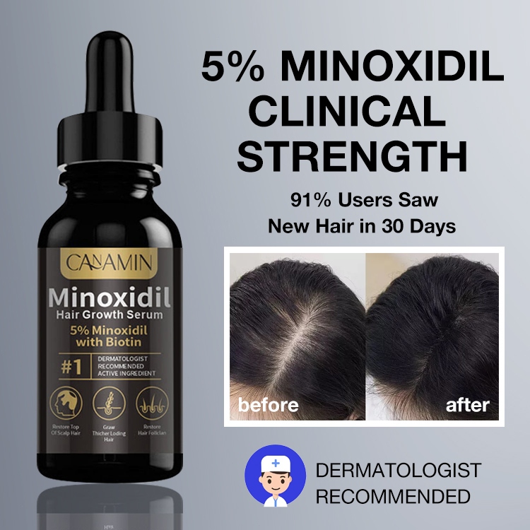 Snapshot of Bald Spot Serum For Hair Regrowth