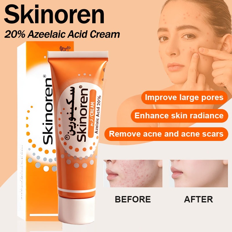 Skinoren 20 Cream 30g For Acne And Dark Spots Original Shopee 