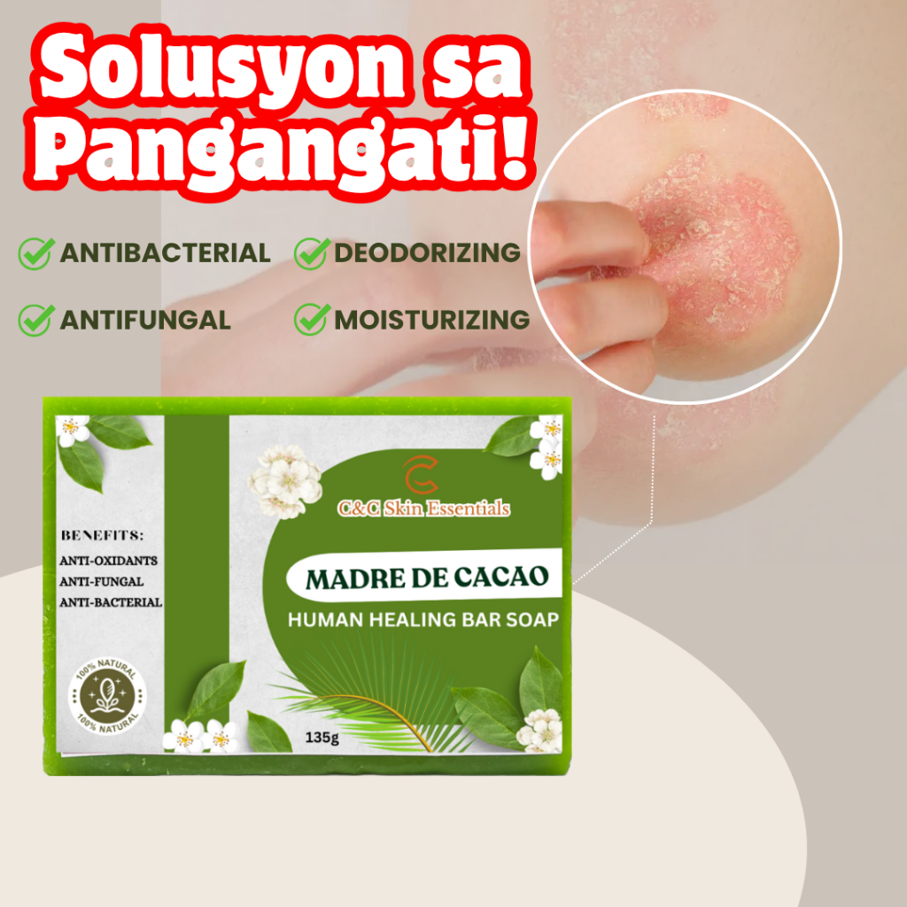 Madre De Cacao Soap for Human, Anti-Bacterial & Anti-Fungal for Itchy ...