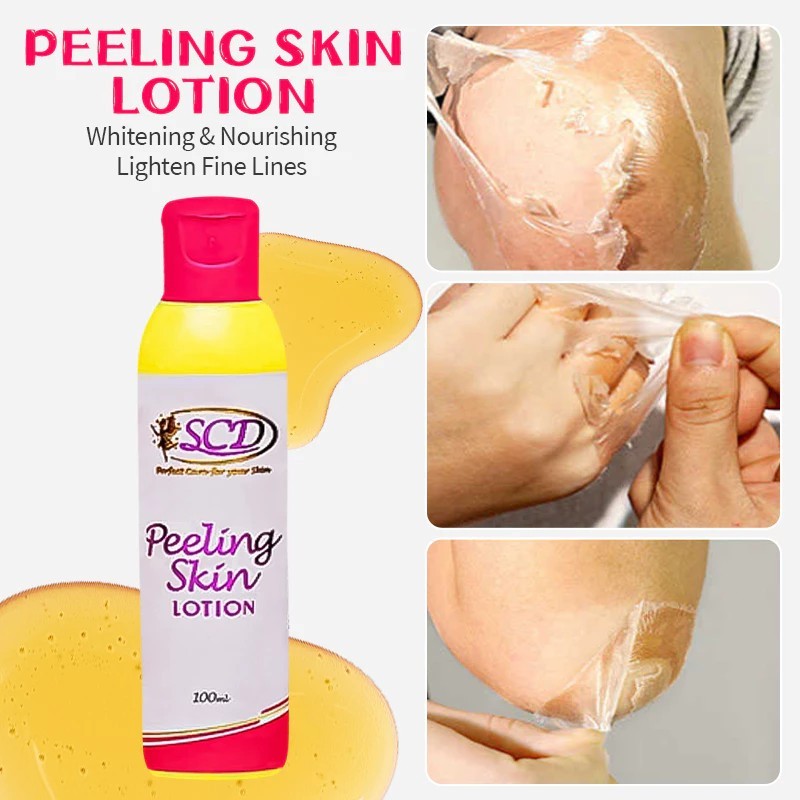SCD Peeling Skin Lotion 100ml – Exfoliates and Renews for Smoother Skin ...