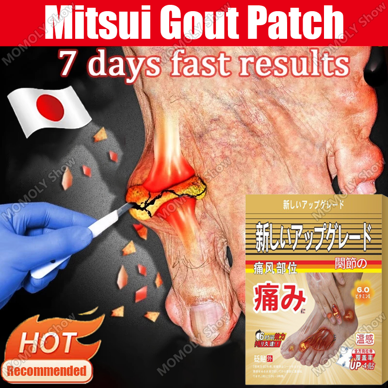 Mitsui Gout Patch Original Gout Treatment Patch Toe Joint Pain Relief ...